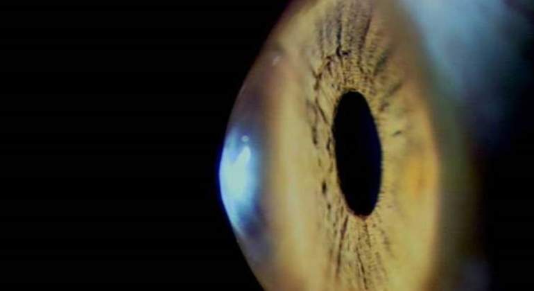 cornea-ojo-europa-press.jpg