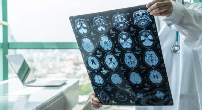 imagenes-cerebrales-tomografia-istock.jpg