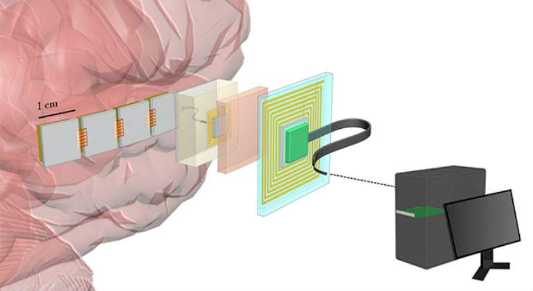 chip-neuronal.jpg
