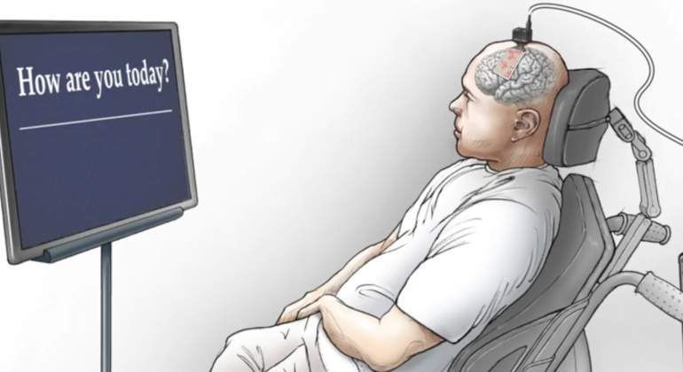 implante-cerebral.jpg