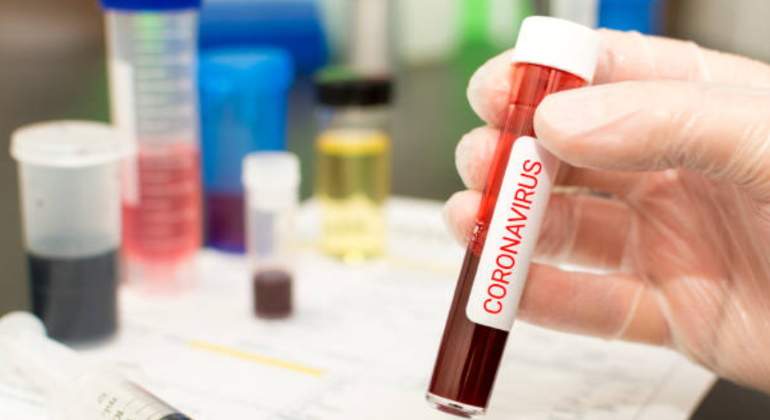 coronavirus-prueba-sangre-770.jpg