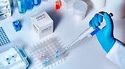 La viróloga Margarita del Val advierte sobre los rebrotes de coronavirus: Nos acercamos a la segunda oleada