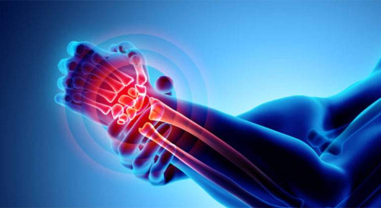 artritis-istock.jpg