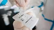 ¿Qué son los test rápidos de antígenos y cómo funcionan?