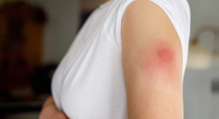 dolor-brazo-vacuna-covid-19.jpg