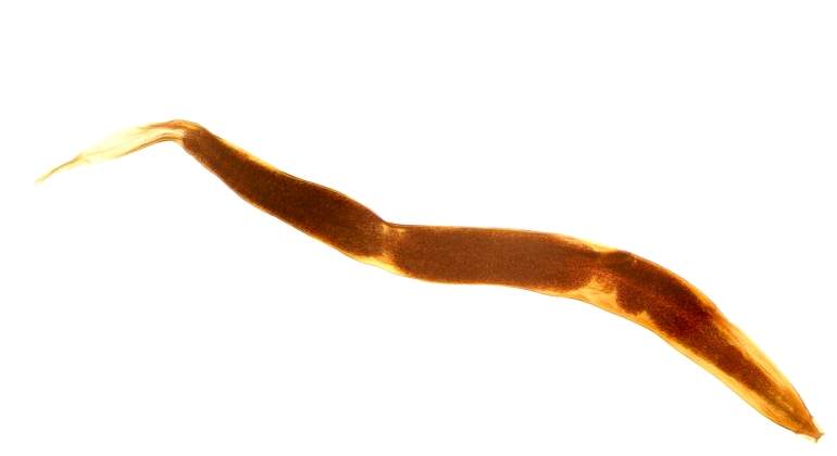 gusano-microscopio-dreamstime.jpg