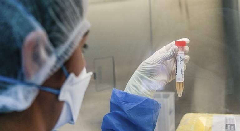prueba-molecular.jpg