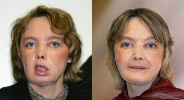 mujer-trasplante-cara-reuters.jpg