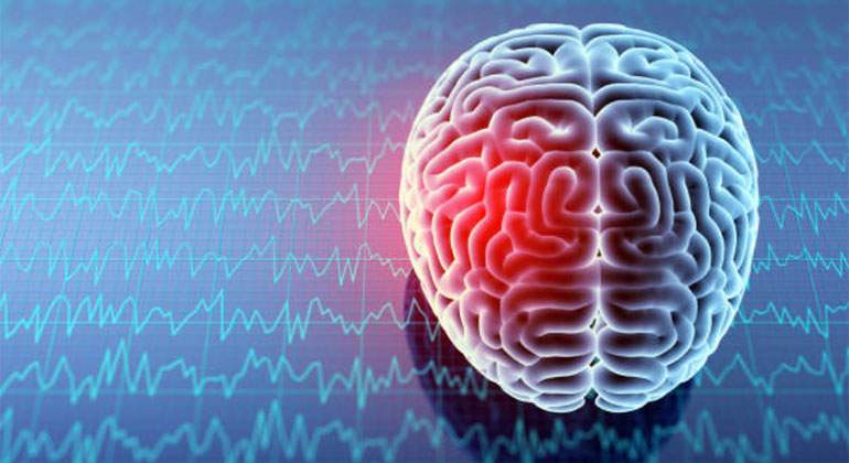 cerebro-lesion-cerebral.jpg