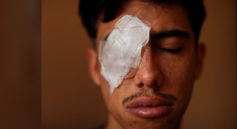 protestas-chile-ojos.reuters.png