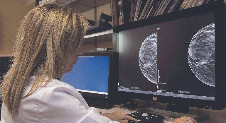 cancer-de-mama-770x420.jpg