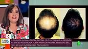 El remedio para la alopecia sí existe: desvelan el tratamiento más efectivo para evitar la caída del pelo