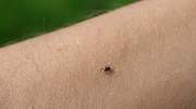 Alerta por garrapatas en España: así se identifican y estos son los posibles síntomas