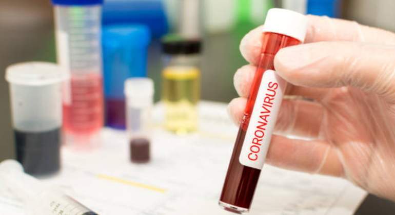 coronavirus-prueba-sangre-770.jpg