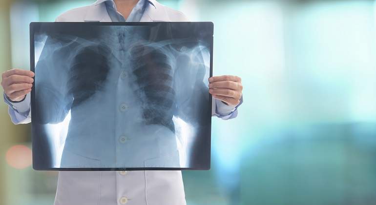 Mujer-con-radiografia-iStock.jpg