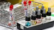 El grupo sanguíneo de una persona influye en la respuesta ante el coronavirus