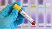 El gerente de Magrudis, sobre la listeriosis: Si hay bacterias en un quirófano, ¿cómo no va a haber en mi fábrica?