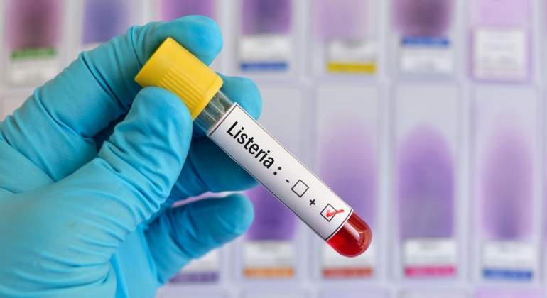 listeria.jpg