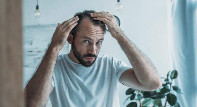 alopecia-androgenica-covid-dreamstime.jpg