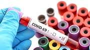 De Merkel a Jacinda Ardern: las mujeres gestionamos mejor la pandemia de coronavirus