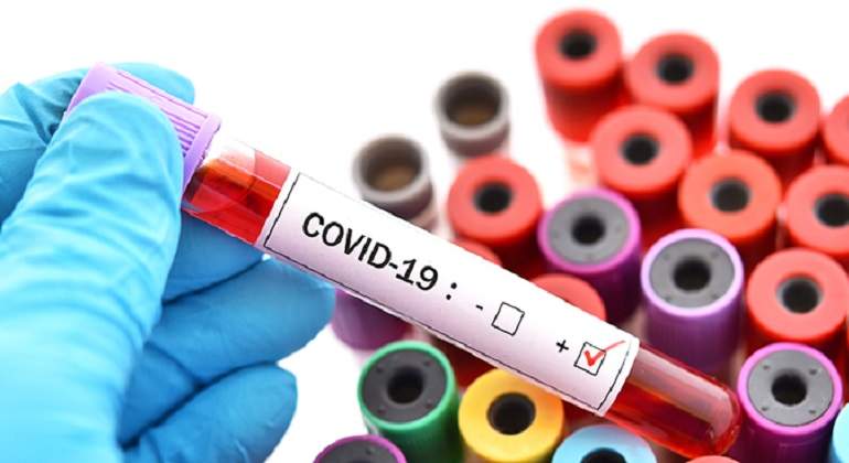 covid-gestion.jpg