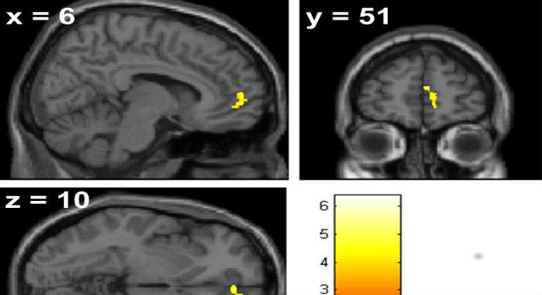 Cervell_111111111.jpg