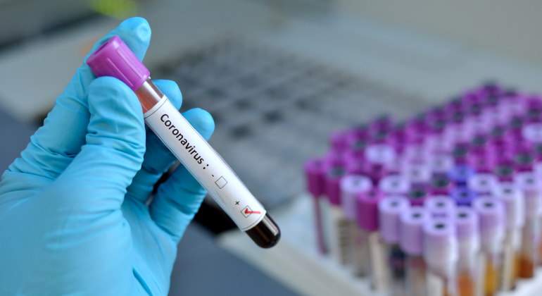coronavirus-prueba-tubo-ensayo-positivo-770-dreamstime.jpg