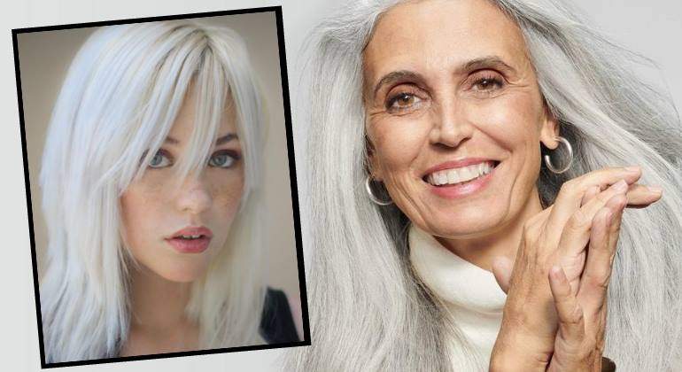 pelo-blanco770.jpg