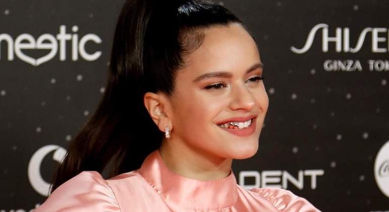 rosalia-dientes-oro-770.jpg