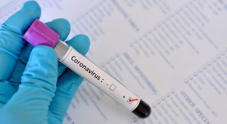 coronavirus-test-escrito-tubo-positivo-770-dreamstime.jpg