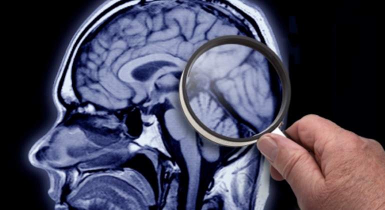 lupa-cerebro-getty.jpg