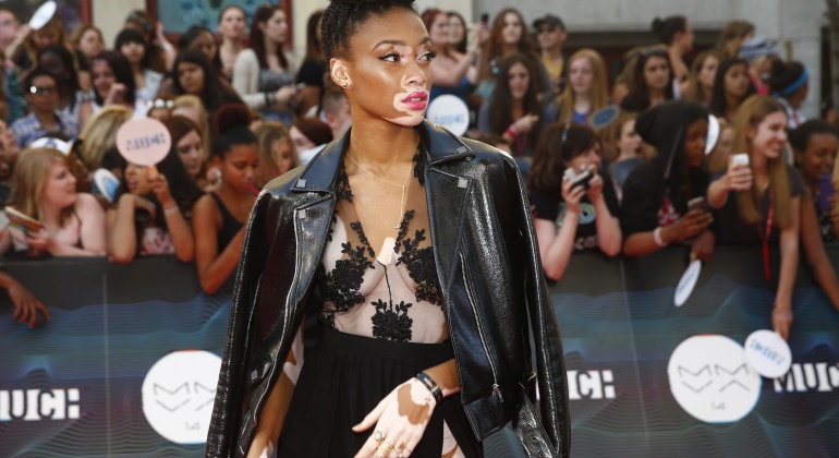 pigmentacion-winnie-harlow-modelos-reuters.jpg