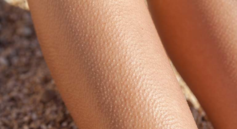 Brazo-con-la-piel-de-gallina-iStock.jpg