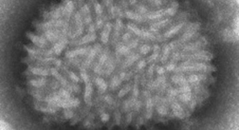 virus-viruela-csic.jpg