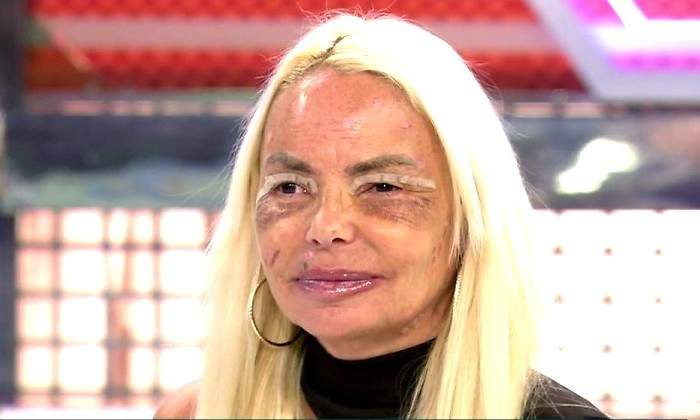 leticia-sabater-operada.jpg