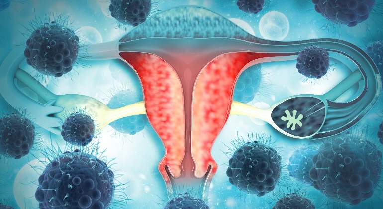 cancer-cuello-de-utero.jpg