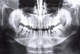 radiografia.jpg