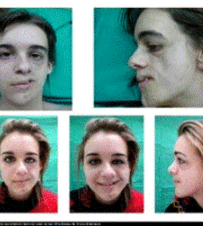trasplante_dentro.gif