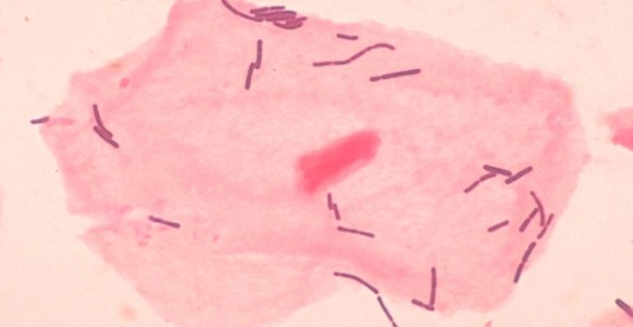 bacteria-lactobacilus-wikimedia-commons.jpg