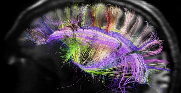 cerebro-scence.jpg