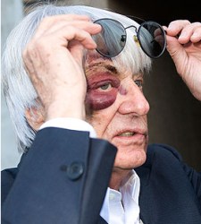 Ecclestone-ojo-morado.jpg