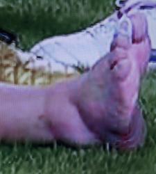 tobillo-messi.jpg