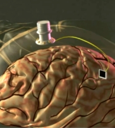 cerebro2.JPG