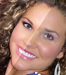 cirugiaphotosop.jpg