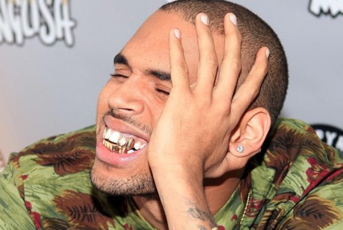chris-brown-dientes.jpg