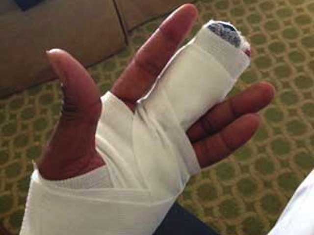 /imag/businessinsider/2013/09/24/cardinals-player-tweeted-photos-of-the-finger-he-severed-while-playing-on-sunday-warning-gross.jpg