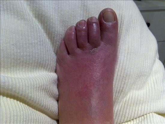 /imag/efe/2009/03/26/2045749w.jpg